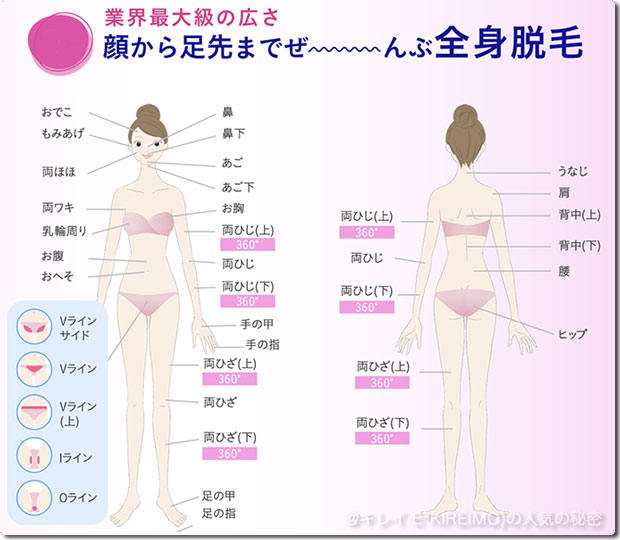 キレイモのスペシャルプランの脱毛範囲は全身33か所